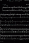 莫扎特D大調(diào)鋼琴奏鳴曲K.284