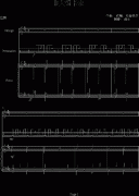 D大調(diào)卡農(nóng)-鋼琴華麗版-帕赫貝爾-Pachelbel